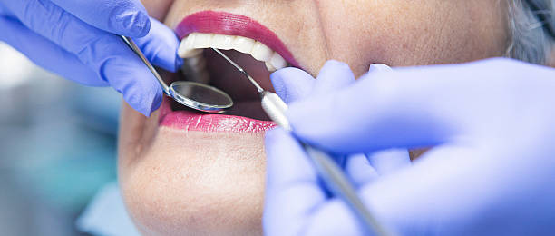 Best Chipped Tooth Repair Near Me  in Valley View, PA